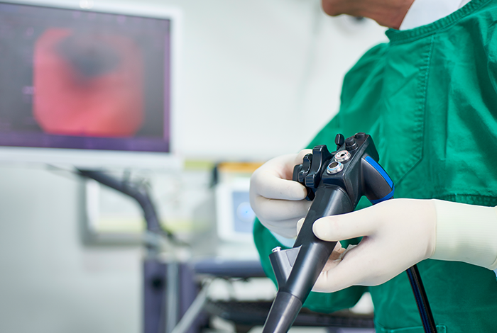 내시경 검사 이미지