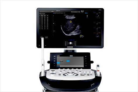 초음파 영상 진단 시스템